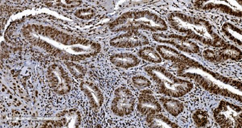 Ku70 Antibody (monoclonal, 3D7)