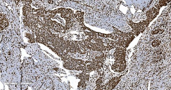 Ku70 Antibody (monoclonal, 3D7)