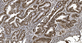 Ku70 Antibody (monoclonal, 3D7)