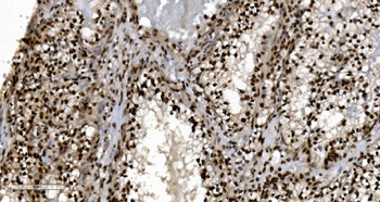 Ku70 Antibody (monoclonal, 3D7)