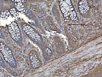 INPPL1 Antibody (monoclonal, 8C13)