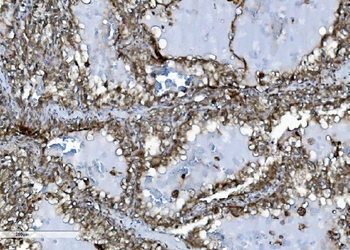 INPPL1 Antibody (monoclonal, 8C13)