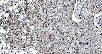 MCM6 Antibody (monoclonal, 10I9)