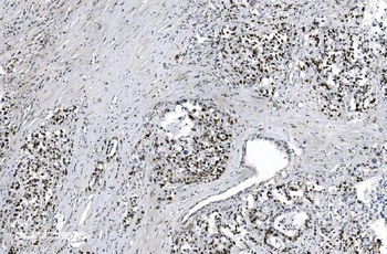 MCM6 Antibody (monoclonal, 10I9)