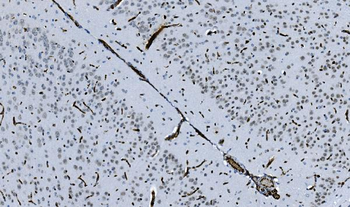 HP1 alpha/CBX5 Antibody (monoclonal, 8G6)
