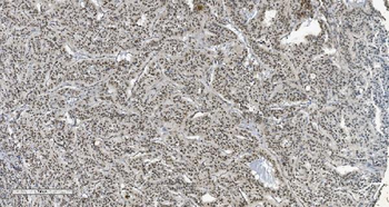 HP1 alpha/CBX5 Antibody (monoclonal, 8G6)