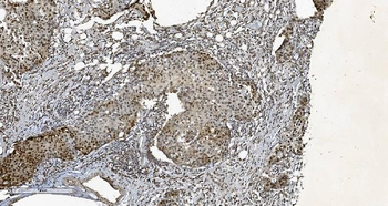 HP1 alpha/CBX5 Antibody (monoclonal, 8G6)