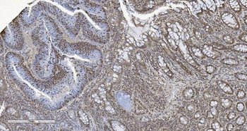 HP1 alpha/CBX5 Antibody (monoclonal, 8G6)
