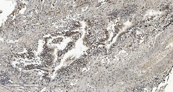 HP1 alpha/CBX5 Antibody (monoclonal, 8G6)