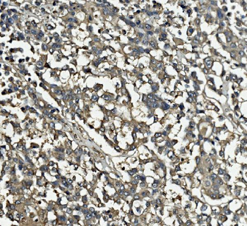 Clathrin heavy chain/CLTC Antibody (monoclonal, 6D3)