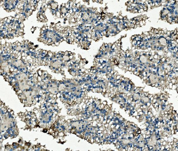 Clathrin heavy chain/CLTC Antibody (monoclonal, 6D3)