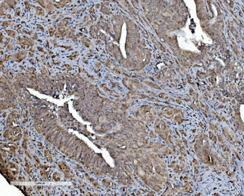 REA/PHB2 Antibody (monoclonal, 2B5)