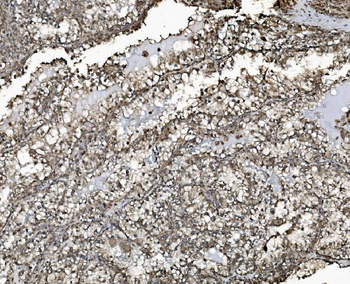 REA/PHB2 Antibody (monoclonal, 2B5)