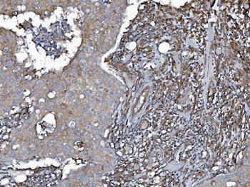 EHD3 Antibody