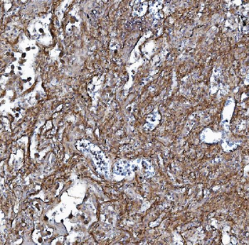 EHD3 Antibody