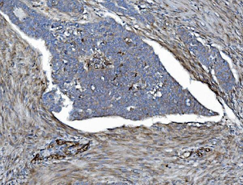 EHD3 Antibody