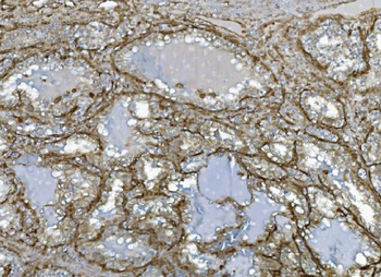 EHD3 Antibody