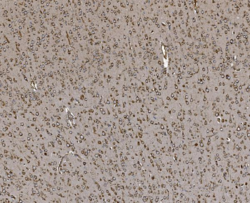 EPRS1/PARS Antibody