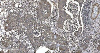 EPRS1/PARS Antibody