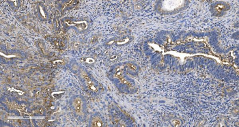 EPRS1/PARS Antibody