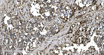 EPRS1/PARS Antibody