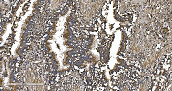 EPRS1/PARS Antibody