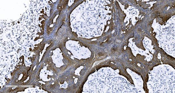 EPRS1/PARS Antibody
