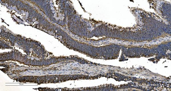 EPRS1/PARS Antibody