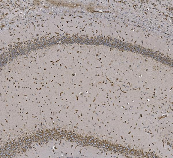 EPRS1/PARS Antibody