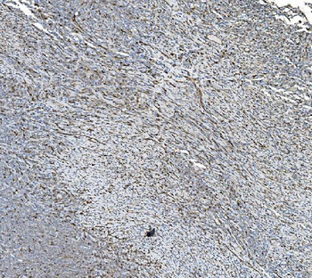 PDIA5 Antibody