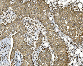 PDIA5 Antibody