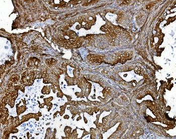 PDIA5 Antibody