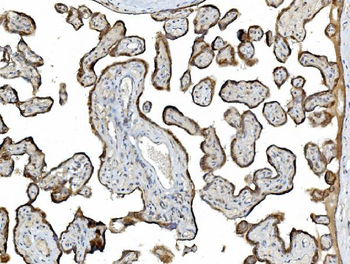 PDIA5 Antibody