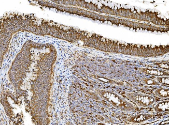 PDIA5 Antibody