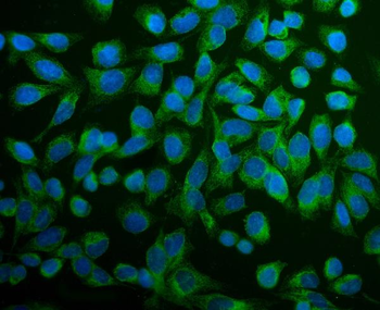 PDIA6 Antibody