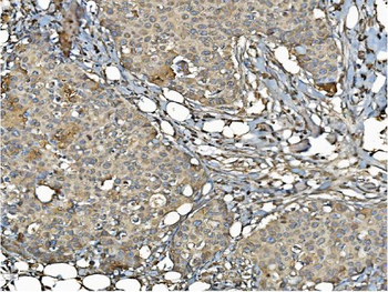 PDIA6 Antibody