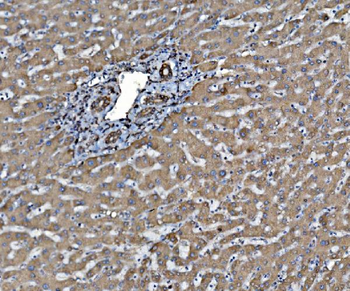 PDIA6 Antibody