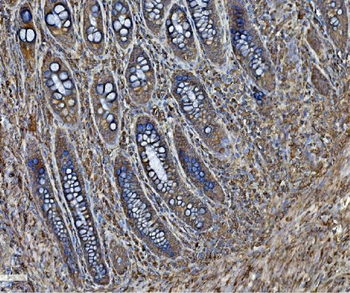 PDIA6 Antibody
