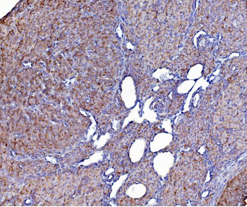 PDIA6 Antibody