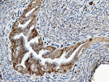 PDIA6 Antibody