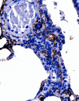 Podoplanin/gp36/Pdpn Rabbit Polyclonal Antibody