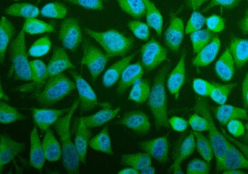 PFAS Rabbit Polyclonal Antibody