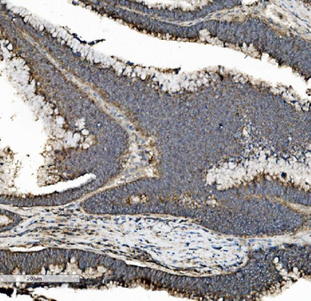 Prohibitin/PHB Antibody