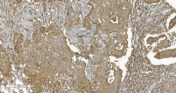 PLTP Rabbit Polyclonal Antibody