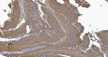 PLTP Rabbit Polyclonal Antibody
