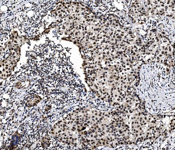 PRDM14 Antibody