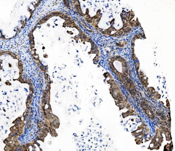 PRDM14 Antibody
