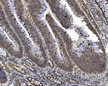 PRDM14 Antibody