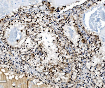PRDM14 Antibody
