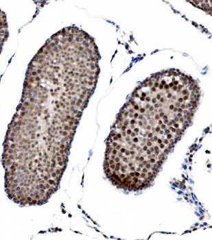 PRDM14 Antibody